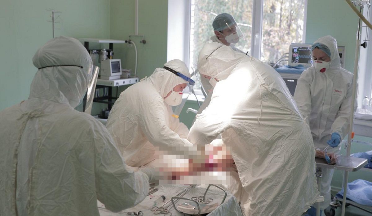Через ускладнення від коронавірусу трьом львів'янам ампутували ноги