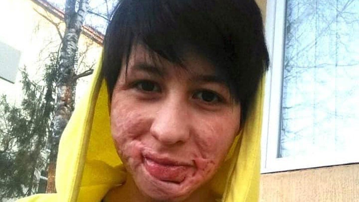 За підпал 16-річної доньки буковинця посадили на 11 років 