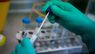 У Франції виявили новий штам коронавірусу, заразніший за «Омікрон»