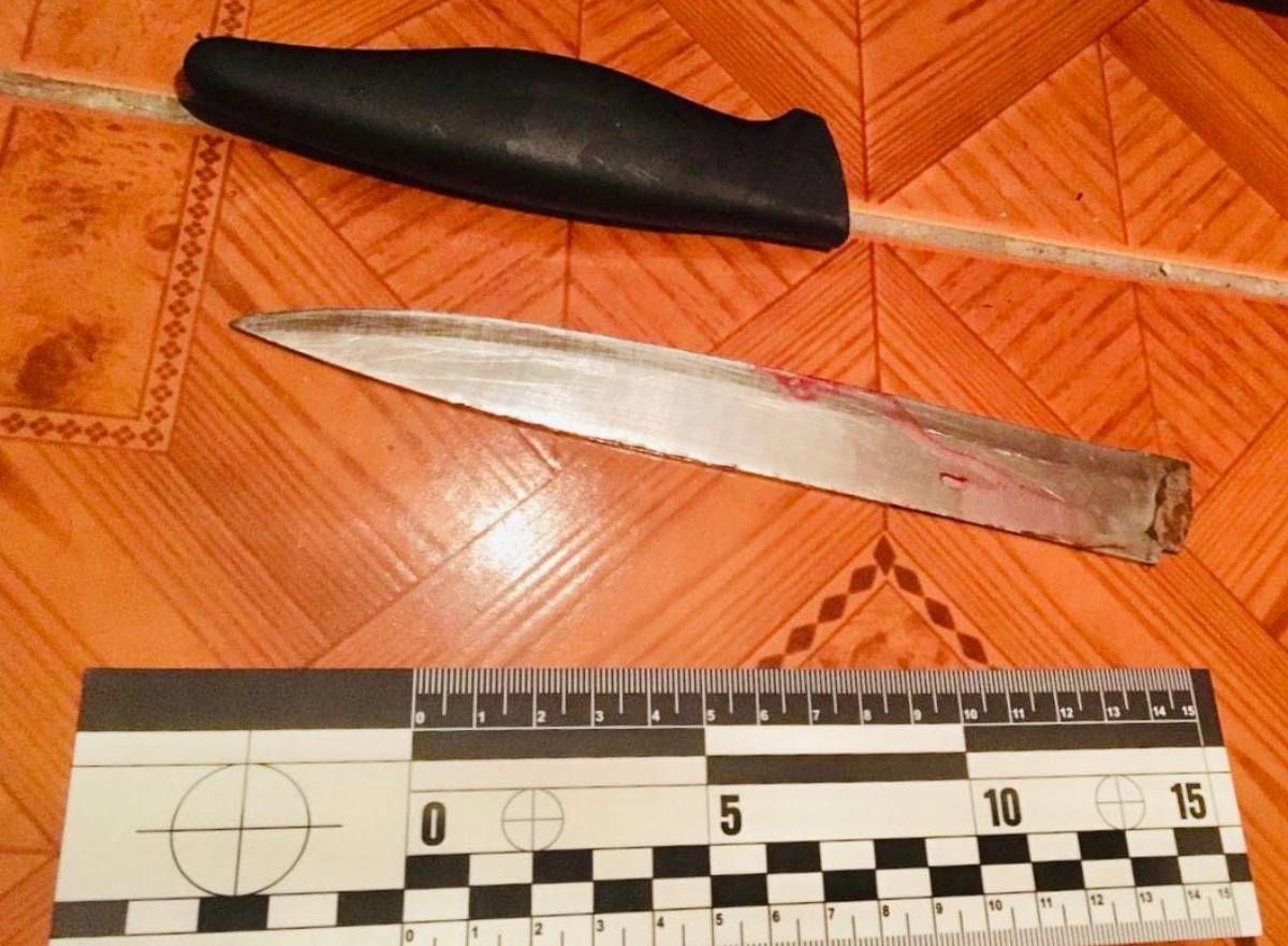 Франківська поліція затримала 34-річного чоловіка за ножове поранення знайомої


