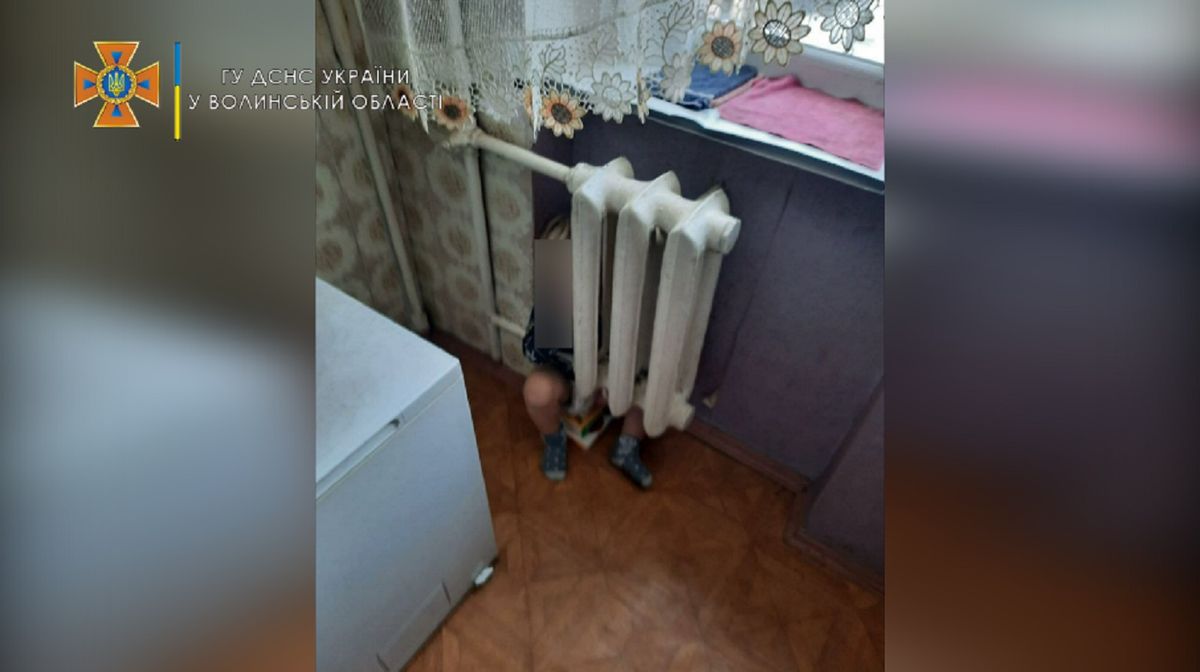 Дворічний хлопчик застряг між гарячими батареями в квартирі у Луцьку 