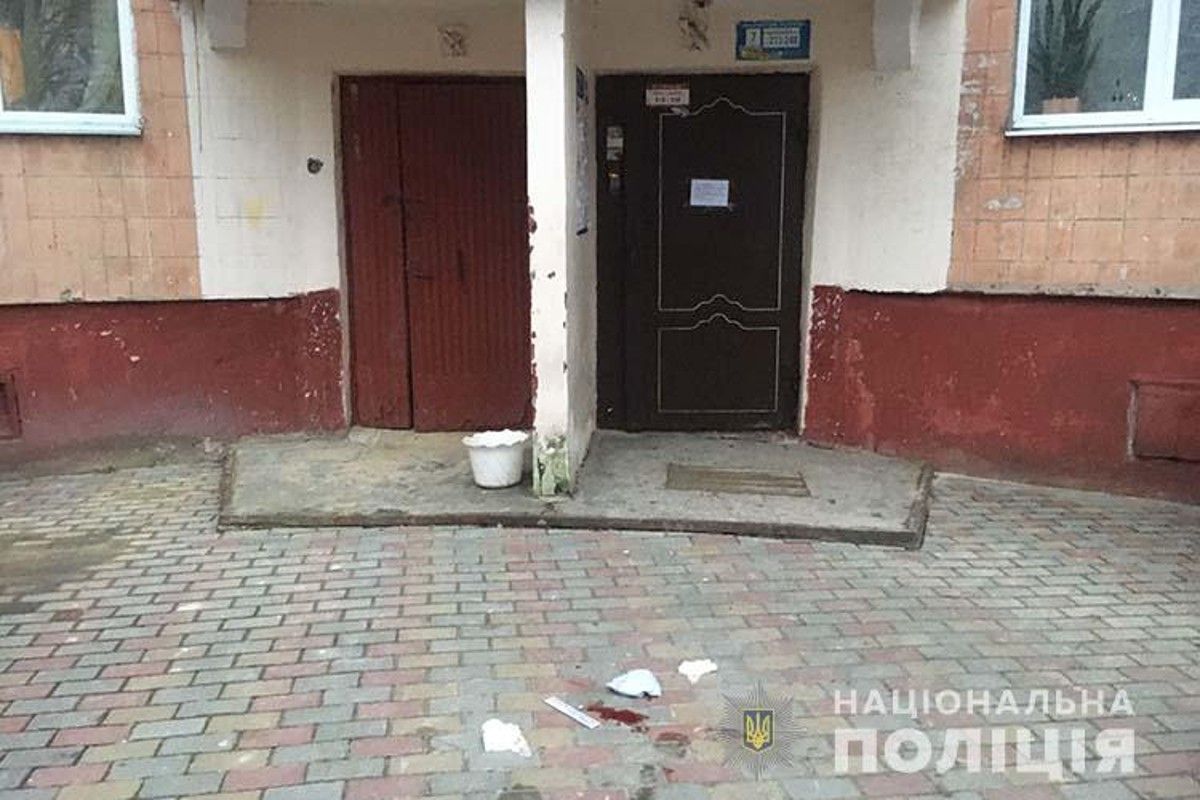 Під час сімейного конфлікту у Тернополі чоловік відкусив матері палець