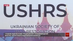 Облисіння вже не проблема – у Львові презентували новітній метод відновлення волосся