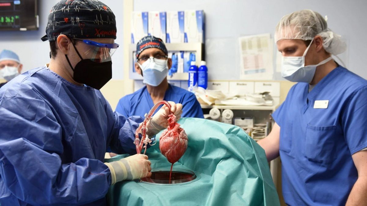 Пересаджене людині серце свині було інфіковане свинячим вірусом