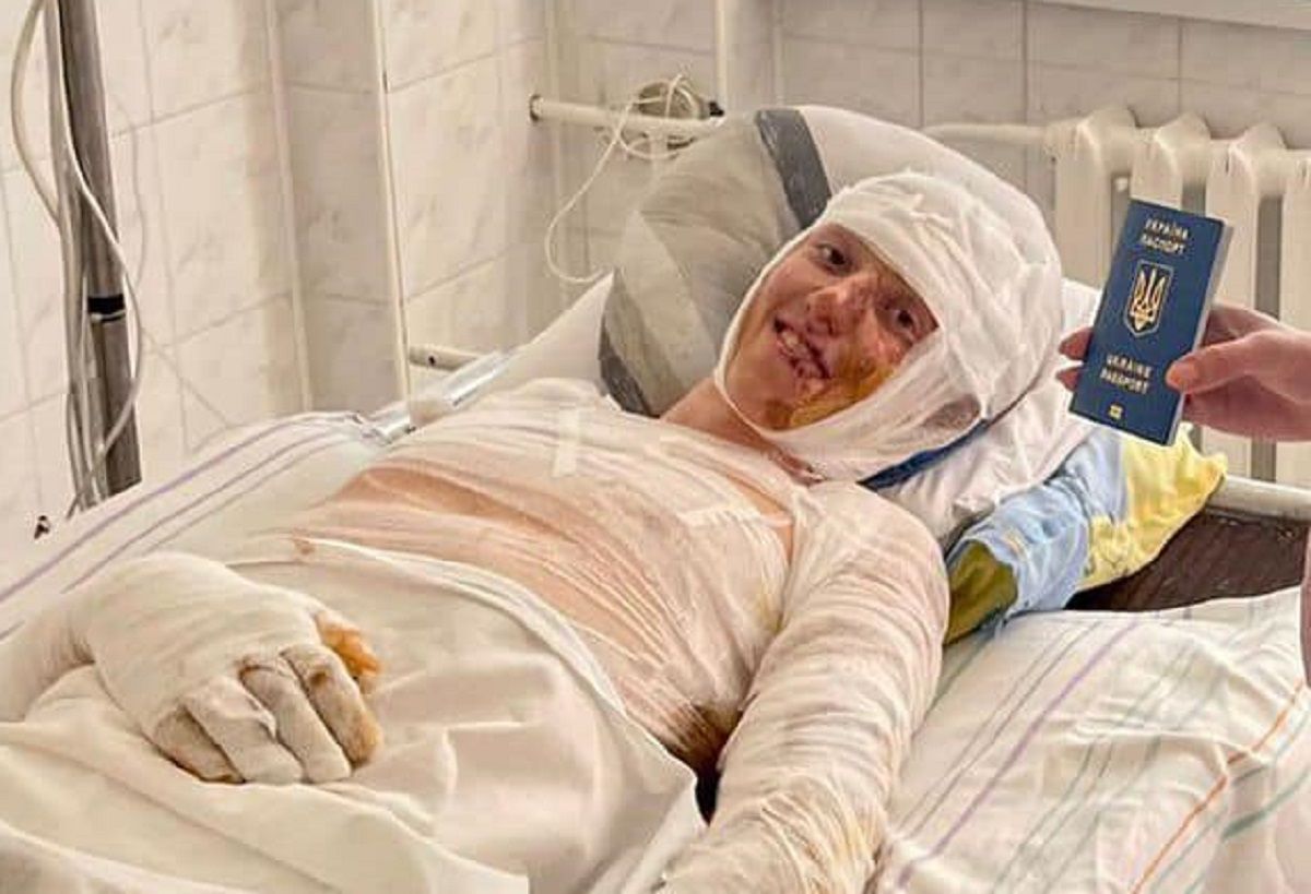 17-річного постраждалого в автокатастрофі з бензовозом відправили на лікування в Італію