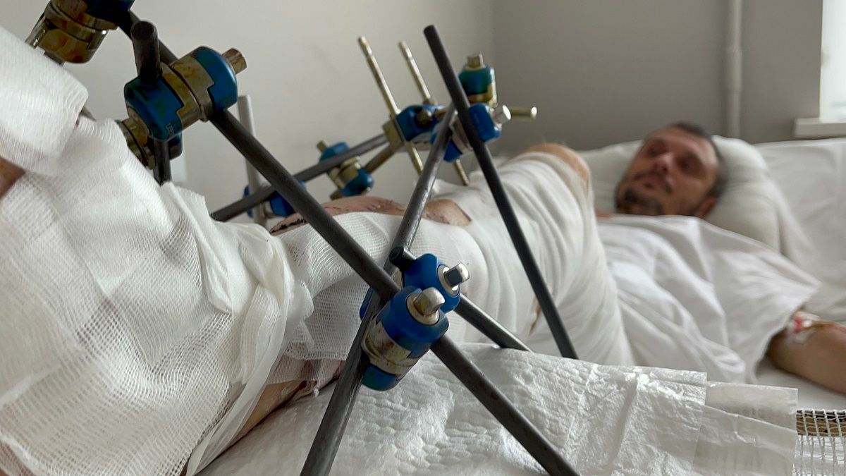 Львівські хірурги врятували 40-річного львів’янина від ампутації ноги