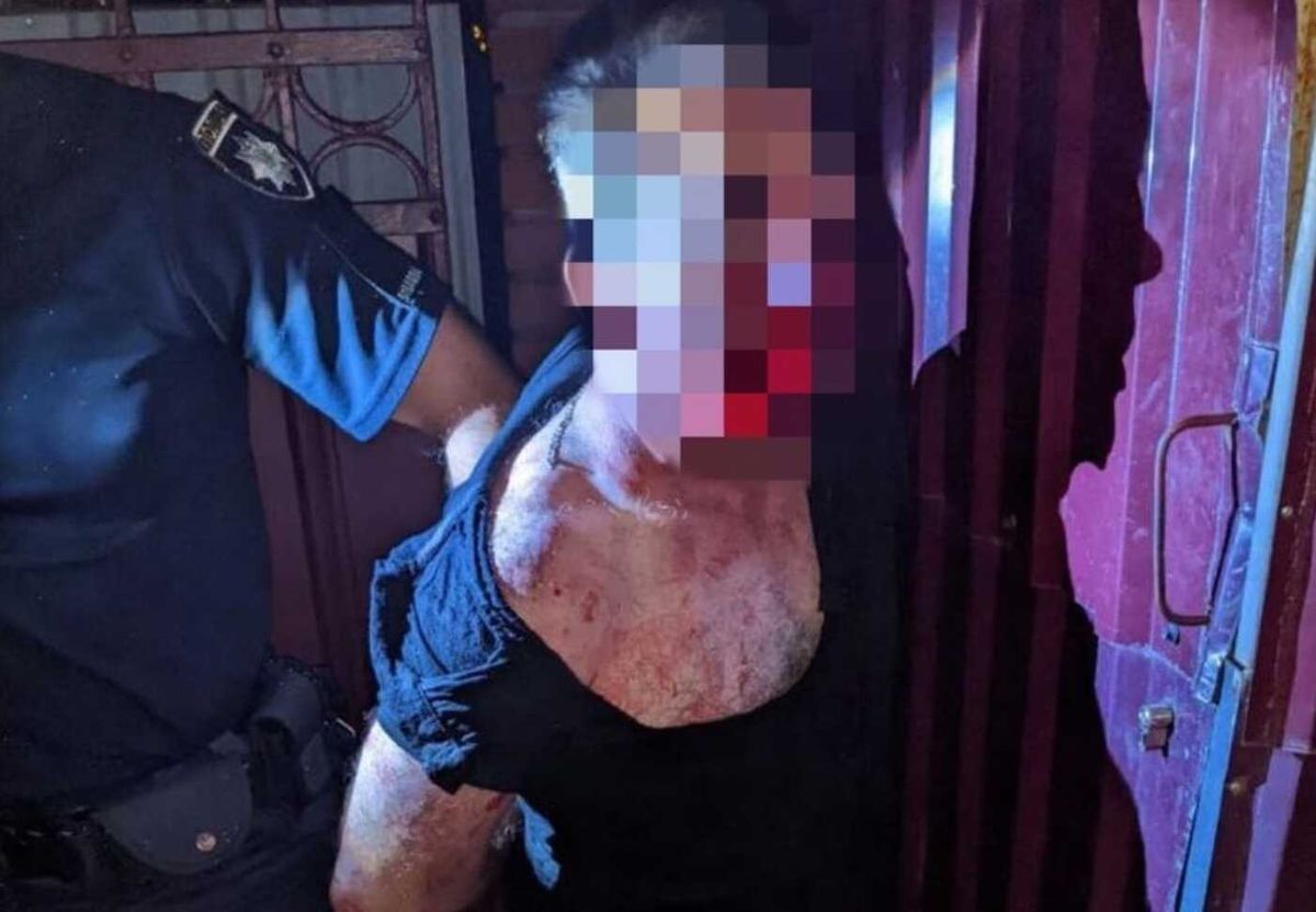 Під час нічної бійки у Львові зарізали 33-річного іноземця
