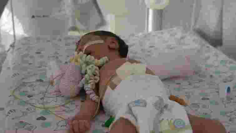Закарпатські лікарі вперше охолодженням врятували новонародженого з асфіксією 