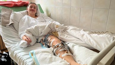 Львівські ортопеди за місяць наростять 18-річній львів’янці 4 см кістки на нозі