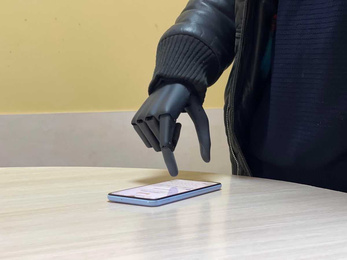 У  реабілітаційному центрі Львова бойовому медику встановили біонічну руку 