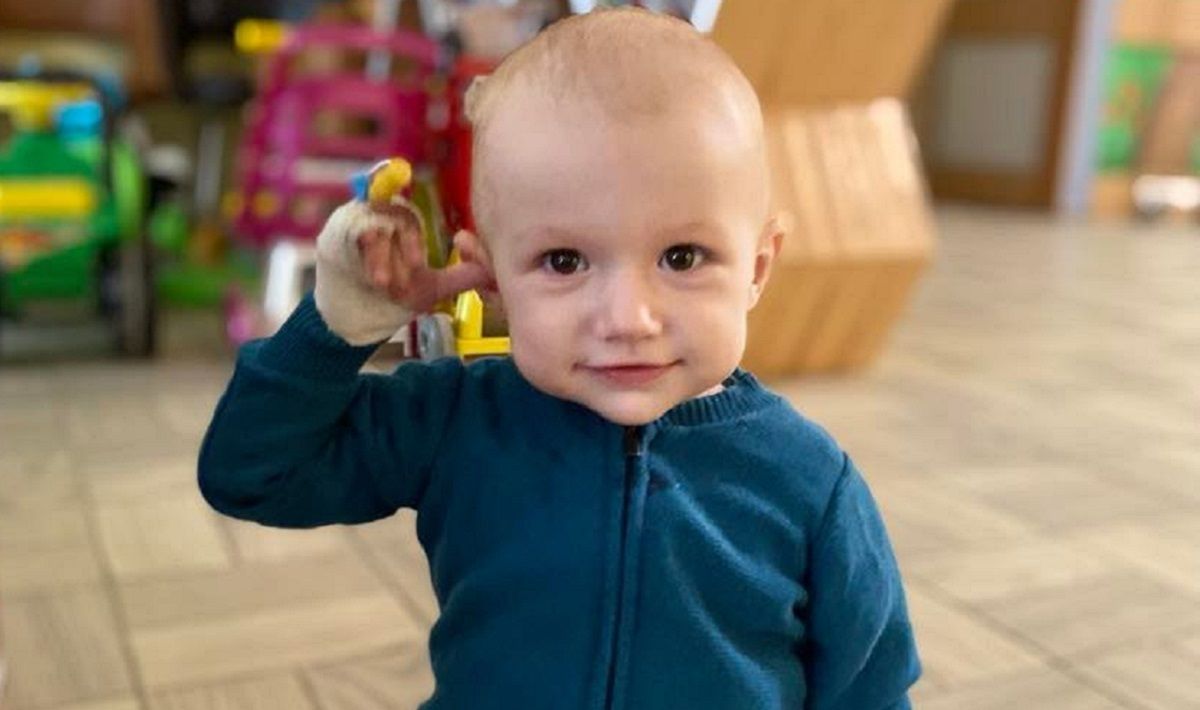 Львівські хірурги видалили однорічному хлопчику пухлину вагою 2,6 кг