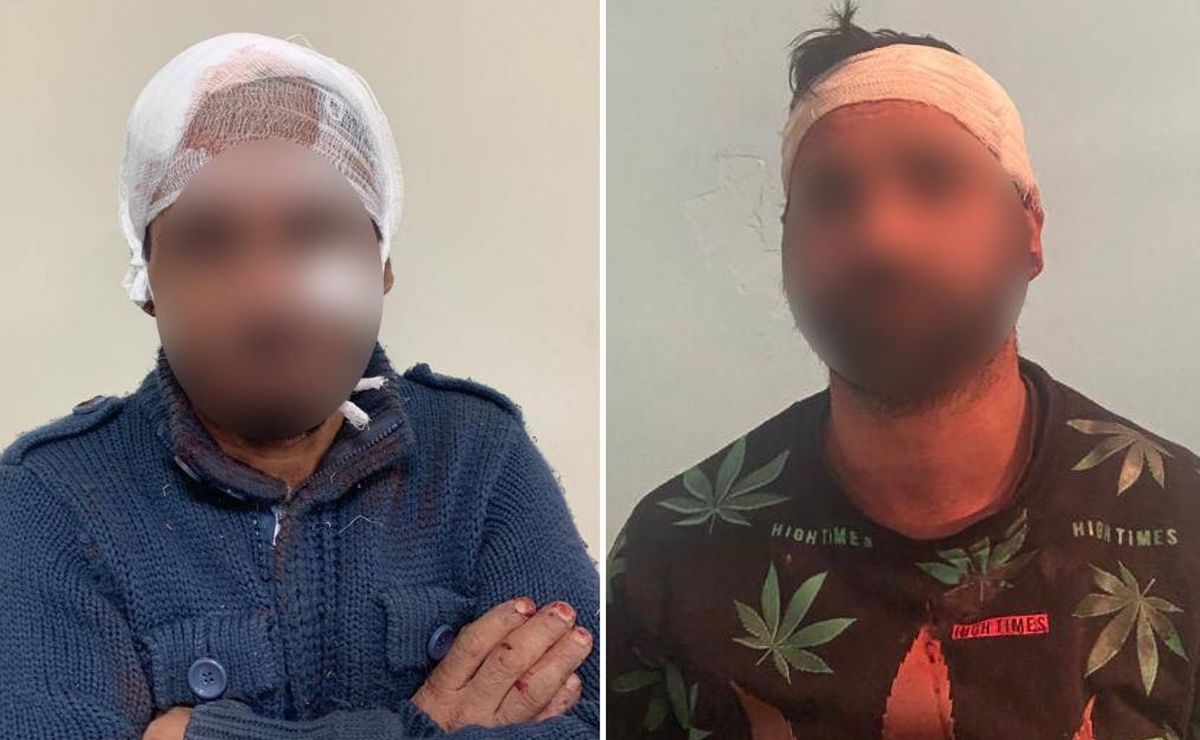Чотирьох людей госпіталізували після бійки між двома родинами на Закарпатті 