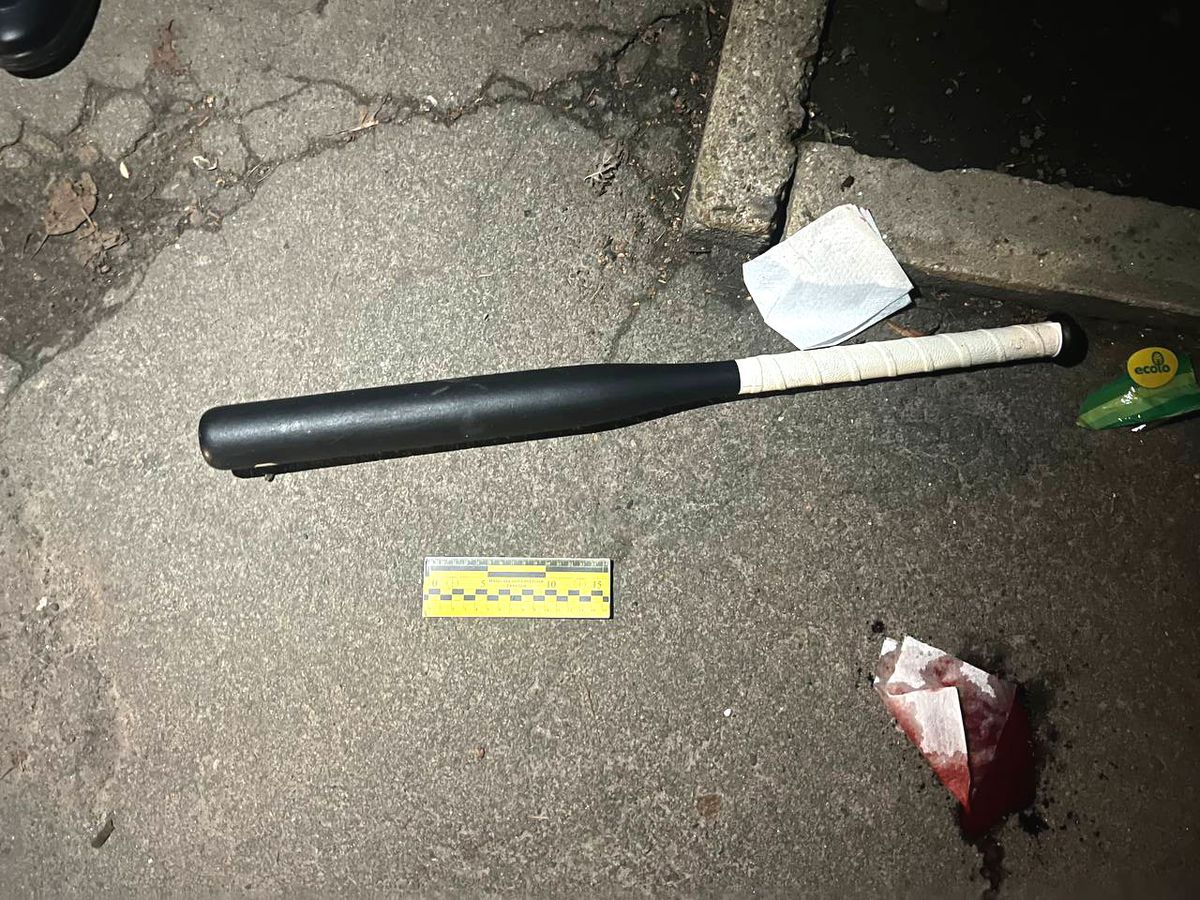 43-річного мешканця Рівного затримали за побиття знайомої битою