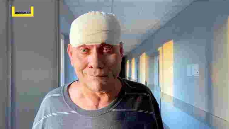 Хірурги пересадили мешканцю Херсонщини м'яз зі спини на голову