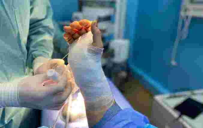Львівські хірурги звільнили пальці руки від оніміння всього за 10 хвилин