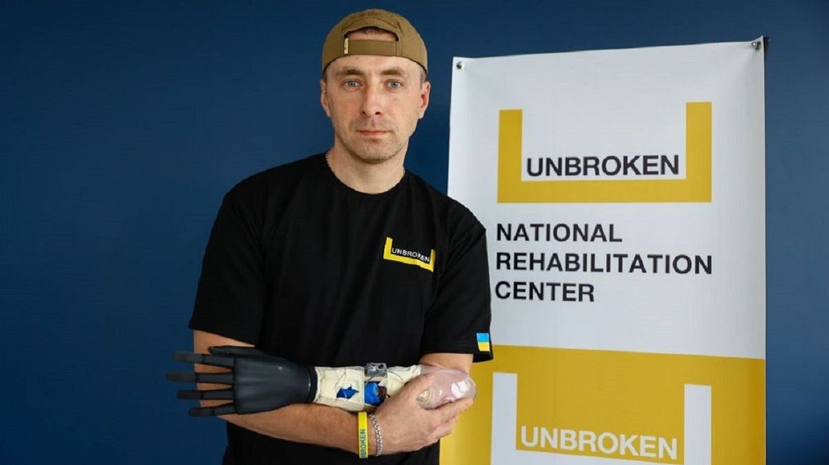 У Львові  відкриють протезну майстерню, де  виготовлятимуть 100 протезів на місяць