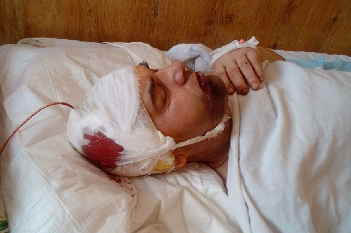 ДБР розслідує побиття солдата у військовій частині на Волині