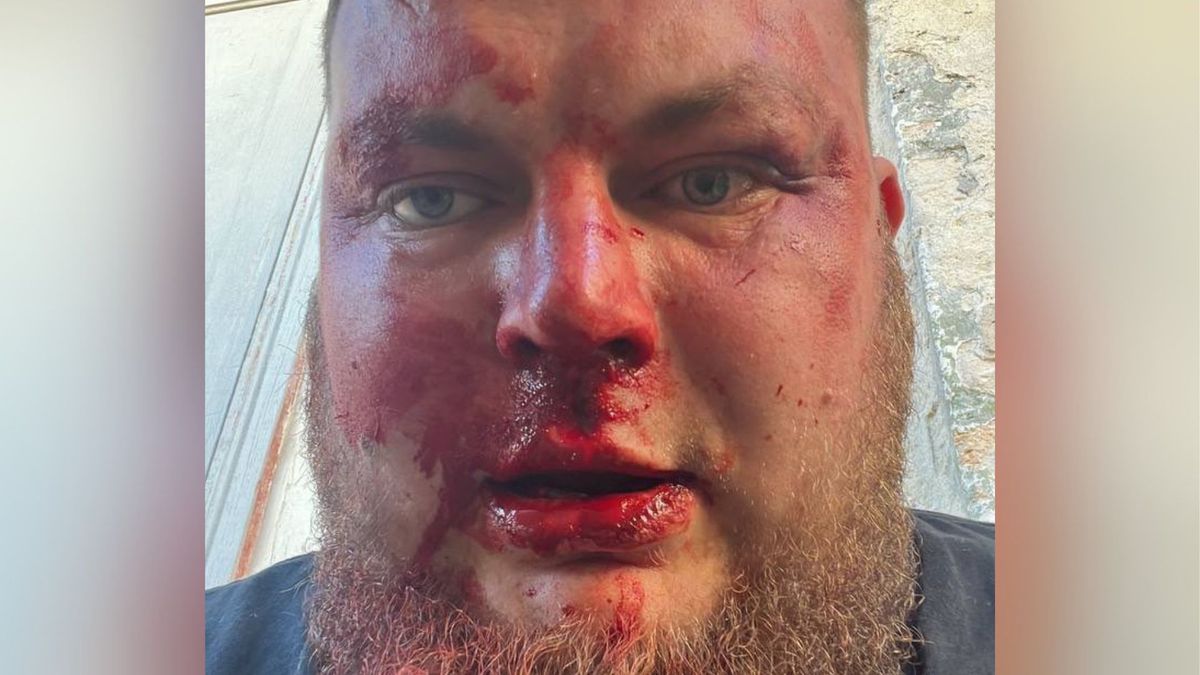 В Одесі напали на громадського активіста Дем'яна Ганула