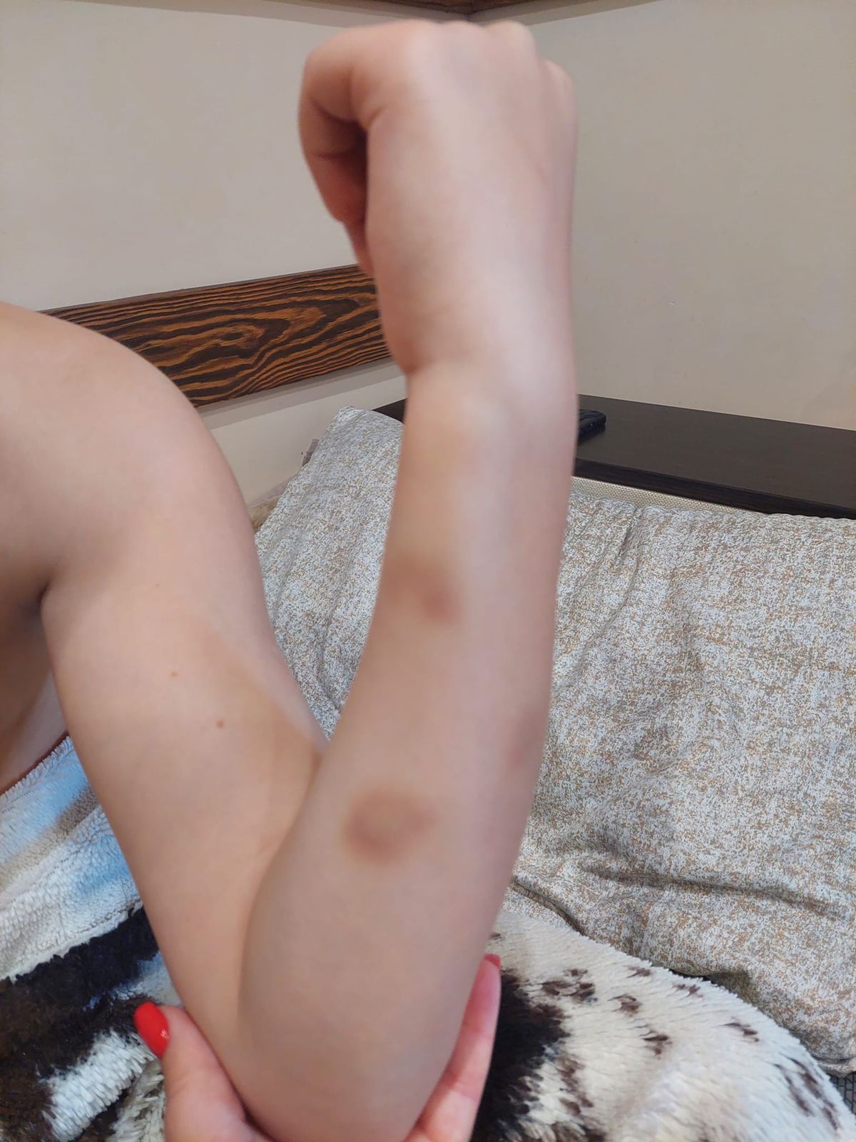 Поліція відкрила справу щодо дружини рівненського прокурора через побиття дитини
