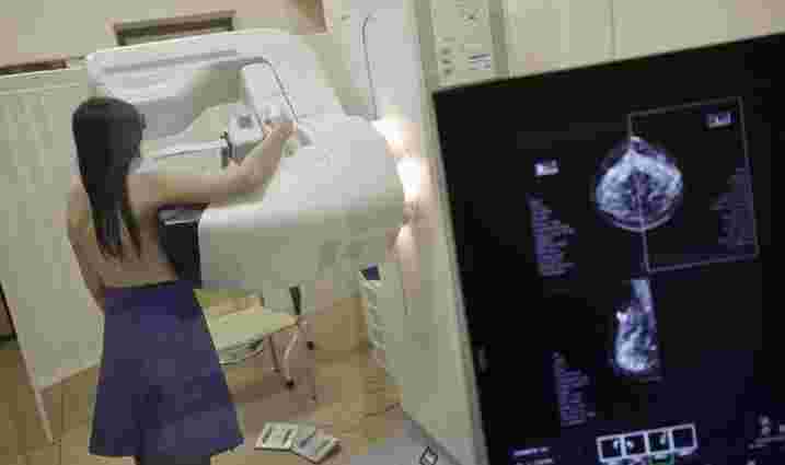 Львів’янок запрошують у вихідний безкоштовно зробити  мамографію