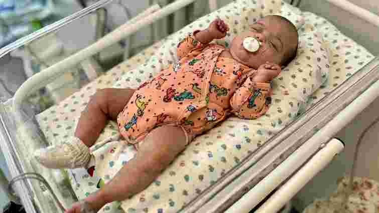 У львівському «Охматдиті» виходили передчасну народжену дівчинку з вагою  700 грамів