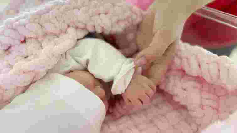 У Львові дитячі хірурги видалили у новонародженої дівчинки кілограмову пухлину