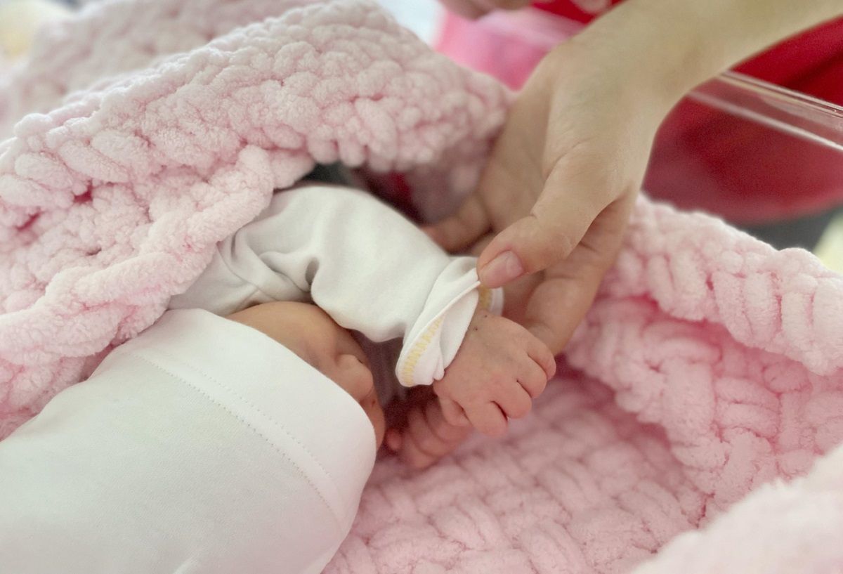 У Львові дитячі хірурги видалили у новонародженої дівчинки кілограмову пухлину