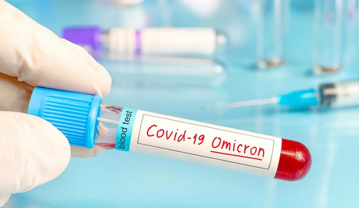 Пік захворюваності на Covid-19 в Україні очікують у середині грудня