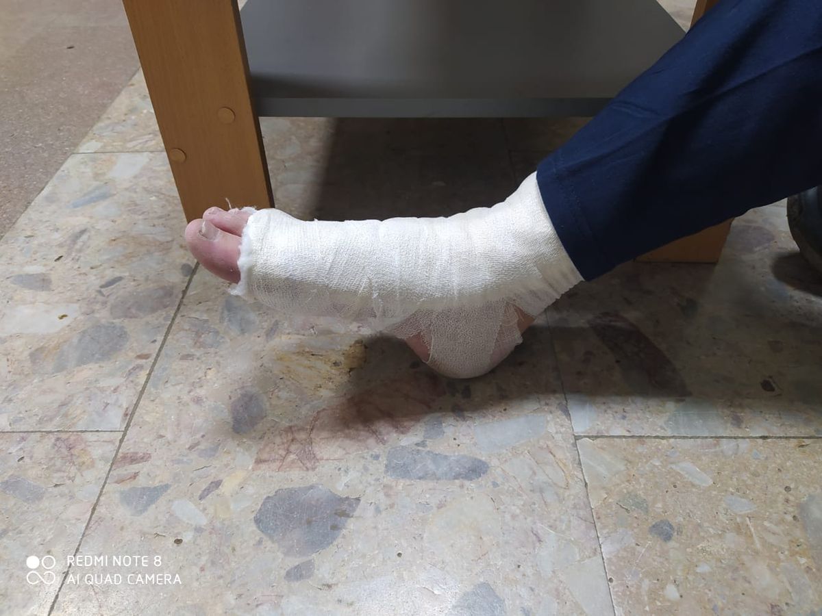 На Закарпатті ухилянт зламав ногу, перелізаючи через загороджувальний паркан