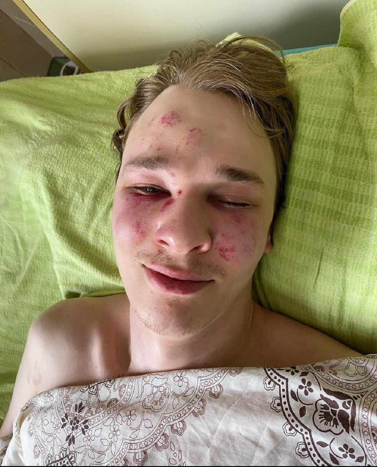 На Закарпатті хлопець намагався скоїти самогубство у ТЦК