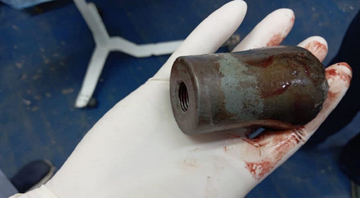 Лікарі польового госпіталю дістали з ноги захисника невідомий суббоєприпас