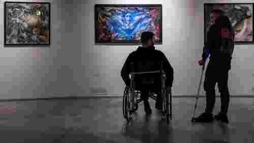 Уряд спростив отримання інвалідності внаслідок війни: пояснення