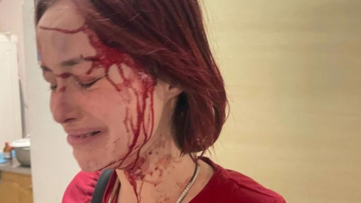 Поліція розслідує заяви про побиття 19-річної одеситки 