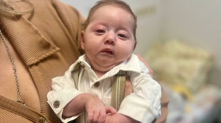 Львівські хірурги врятували новонародженого хлопчика з надзвичайно рідкісною вадою