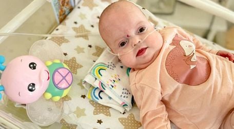 Лікарі Львова виходили народжене на 24 тижні вагітності немовля із вагою 600 г