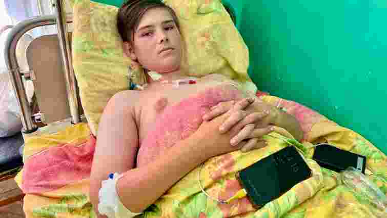 16-річний хлопець з Львівщини під час дощу упав з велосипеда і отримав складні переломи 