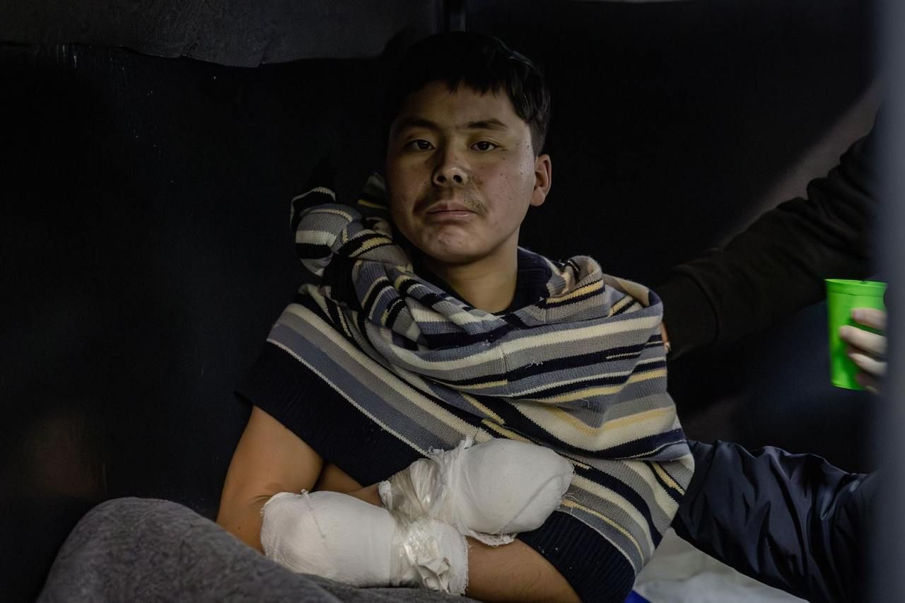 Полонений військовий КНДР. Фото СБУ