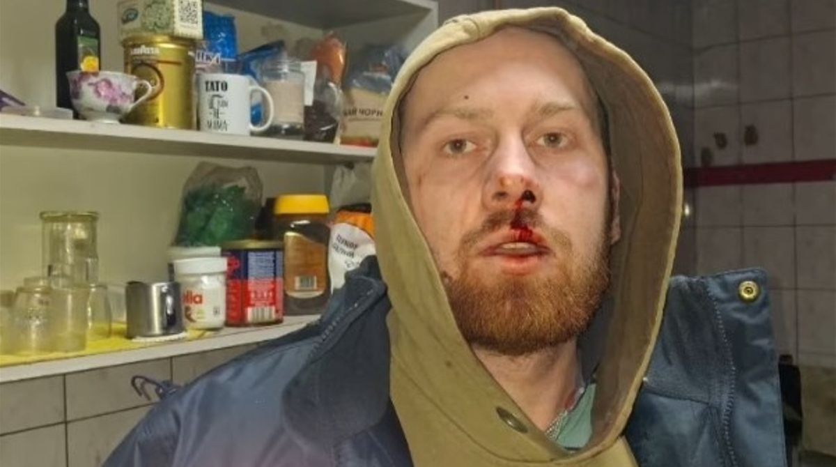 Івано-Франківський ТЦК відреагував на звинувачення у побитті блогера