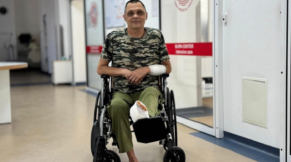 Через опік пальця 50-річний мешканець Львівщини мало не втратив ногу