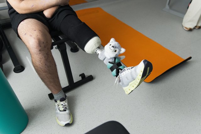 Серед пацієнтів Superhumans є тренд - плюшеві звірятка на протезах