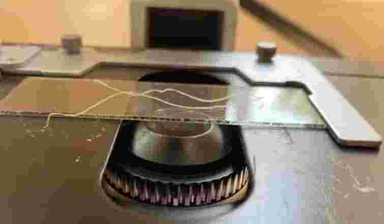 Лікарі витягли з ока волинянки 14-сантиметрового гельмінта