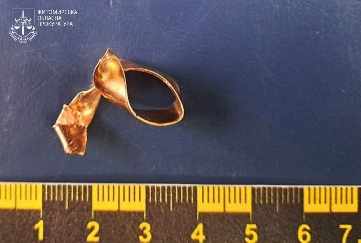 На Житомирщині працівник моргу зрізав обручку з руки загиблого військового