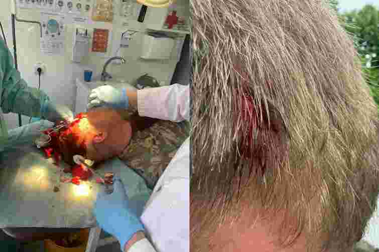 На Закарпатті селяни з камінням та цеглою напали на прикордонників