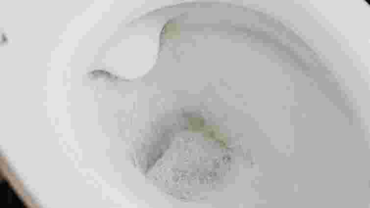 Як легко прибрати вапняний наліт з унітаза: простий домашній засіб з приємним ароматом