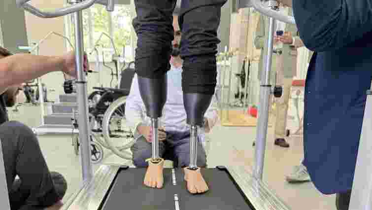 На Закарпатті за допомогою 3D-друку вперше встановили протези пацієнту з подвійною ампутацією