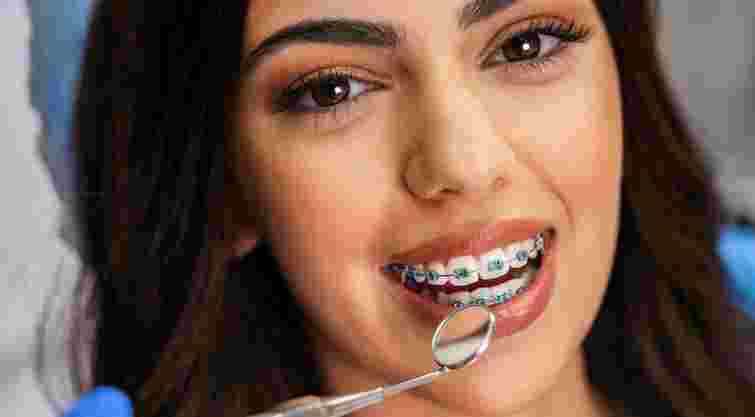 Покращення не тільки усмішки, а й здоровʼя: навіщо вирівнювати зуби та прикус