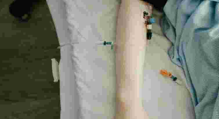 У Стрию госпіталізували 10 дітей, які отруїлись під час подорожі на Закарпатття