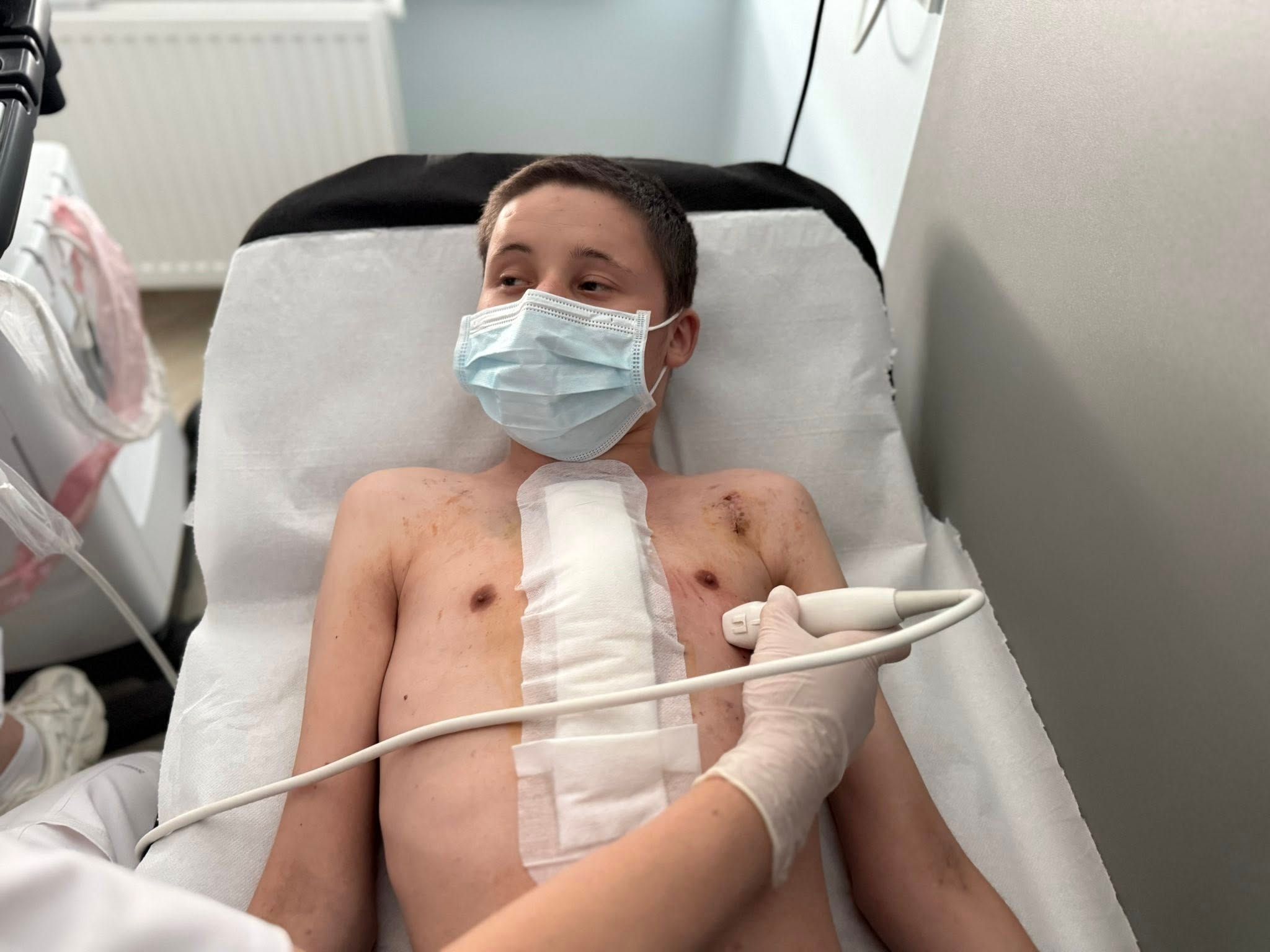 Пацієнт попри слабкість почувається добре, а його нове серце працює стабільно.