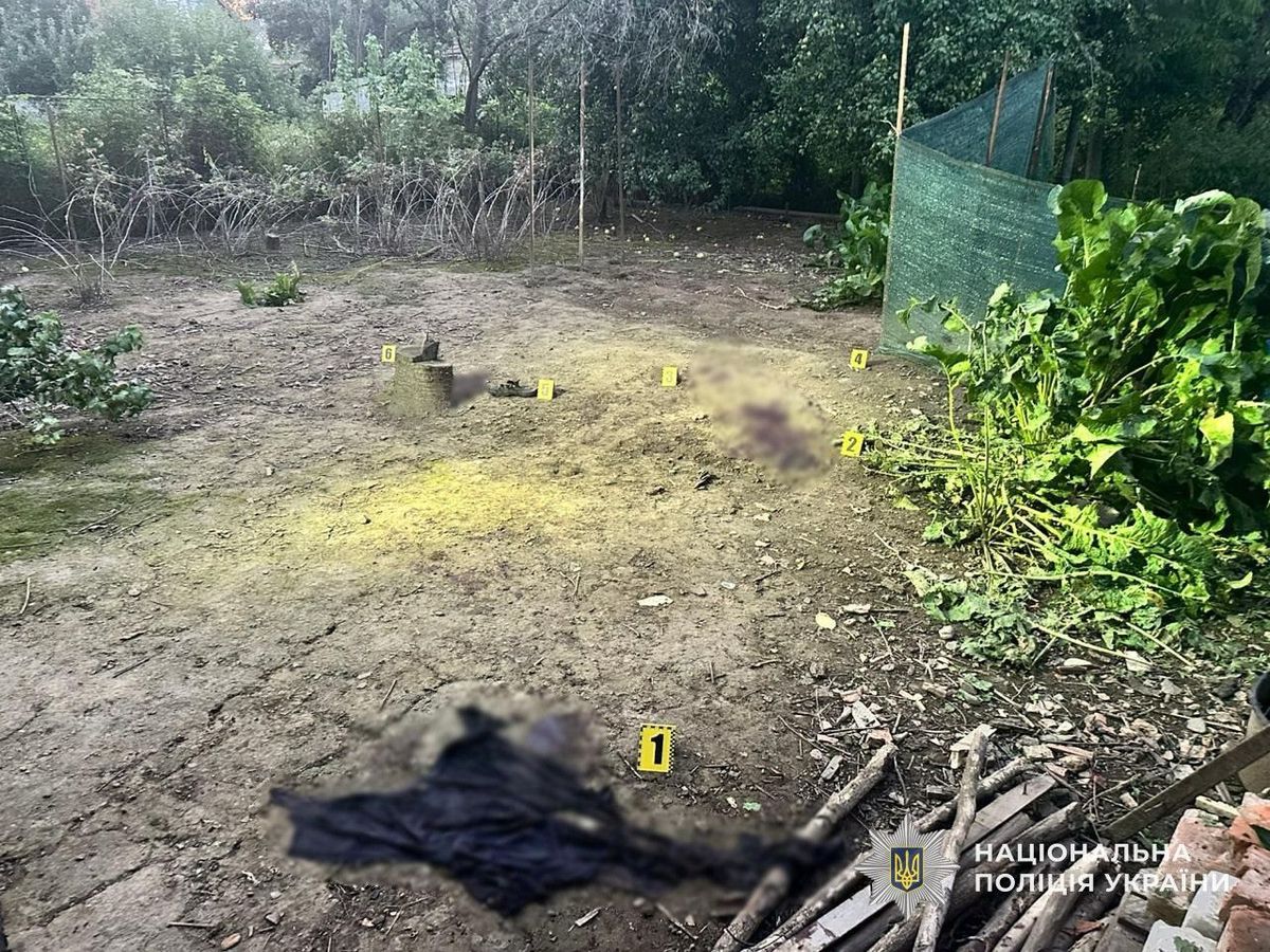 На Закарпатті від вибуху гранати підлітку відірвало руку та ногу