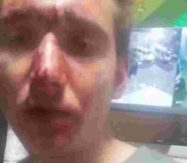 У Рівненському ТЦК прокоментували відео мобілізованого з розбитим обличчям 